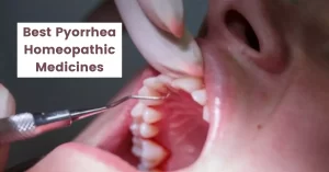 Best 10 Pyorrhea Homeopathic Medicine – Causes & Treatment