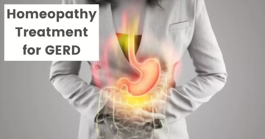 GERD Disease Homeopathic Treatment – Symptoms & Best Medicines