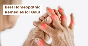 Homeopathy for Gout – Causes, Symptoms & Best 10 Medicines