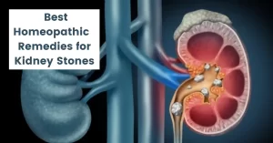Homeopathic Remedies for Kidney Stone – Causes & Cure