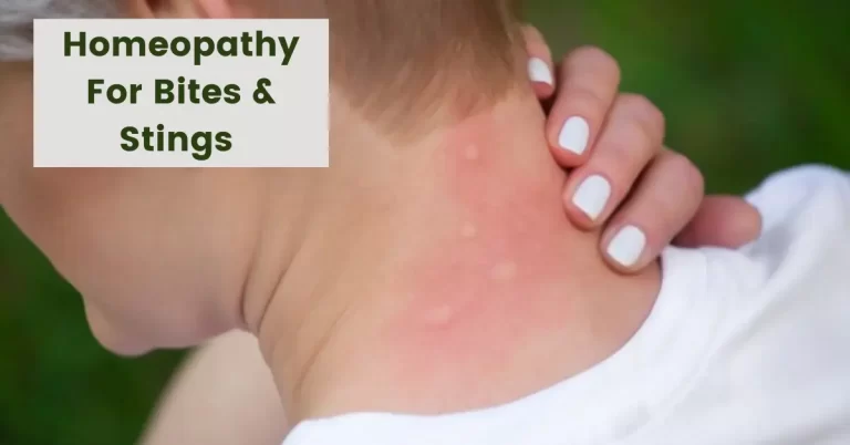 Homeopathy for Bites and Stings – Best 10 Medicines