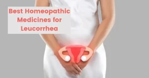Leucorrhea – Symptoms, Causes & Best Homeopathic Medicines