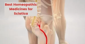 Homeopathy for Sciatica – Symptoms, Causes & Best Medicines