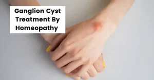 Ganglion Cyst Wrist, Foot, Finger – Treatment By Homeopathy