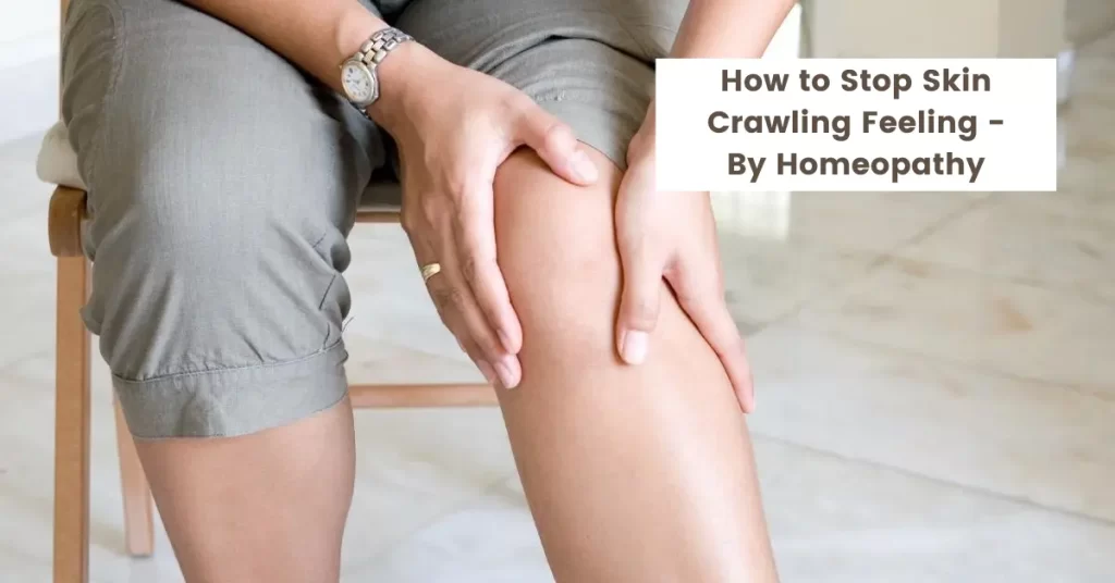 How to Stop Skin Crawling Feeling - Treatment by Homeopathy