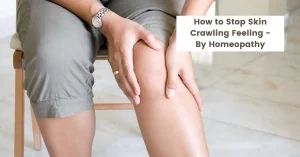 How to Stop Skin Crawling Feeling – Treatment by Homeopathy