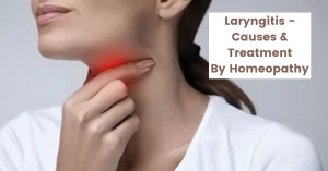 Is Laryngitis Contagious? Causes & Treatment by Homeopathy