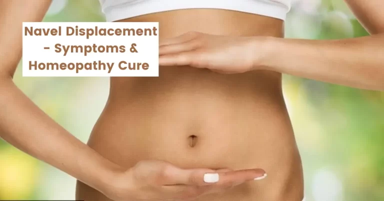 Navel Displacement, Pain – Symptoms, Causes & Homeopathy