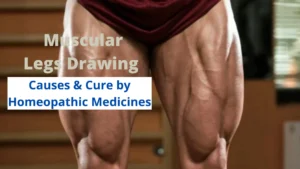 Muscular Legs Drawing – Causes & Best Homeopathic Medicines