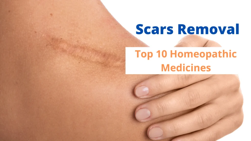 Scars Removal - The Best 10 Homeopathic Medicines