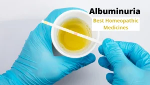 Albuminuria – Causes, Symptoms & Best Homeopathic Medicines