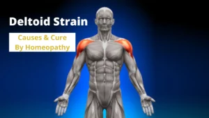 Deltoid Strain – Causes & Cure by Best Homeopathic Medicines