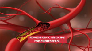 Top 10 Homeopathic Medicine For Cholesterol