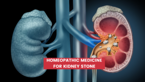 Top 10 Homeopathic Medicine For Kidney Stone