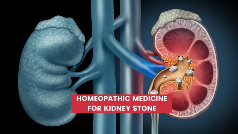 Top 10 Homeopathic Medicine For Kidney Stone