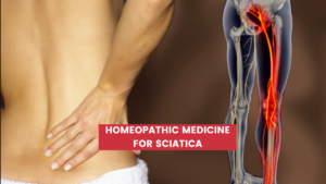 Top 10 Homeopathic Medicine For Sciatica
