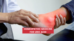 Top 10 Homeopathic Medicine For Uric Acid