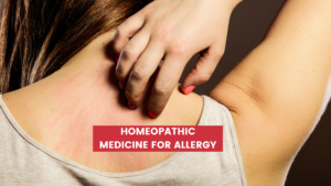 Top 10 Homeopathic Medicine For Allergy