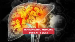 Top 10 Homeopathic Medicine For Fatty Liver