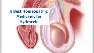 8 Best Homeopathic Medicine for Hydrocele